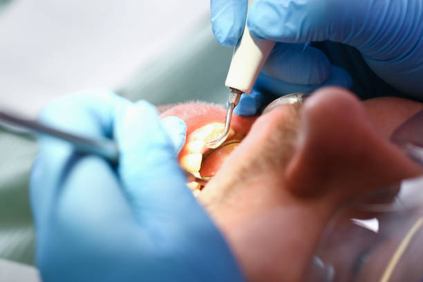 Professional Emergency Dental Service in MS